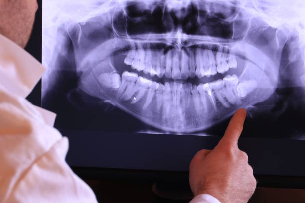 Best Chipped Tooth Repair Near Me  in St Stephens, NC